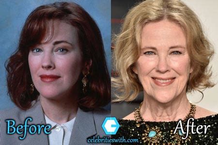 catherine o'hara plastic surgery